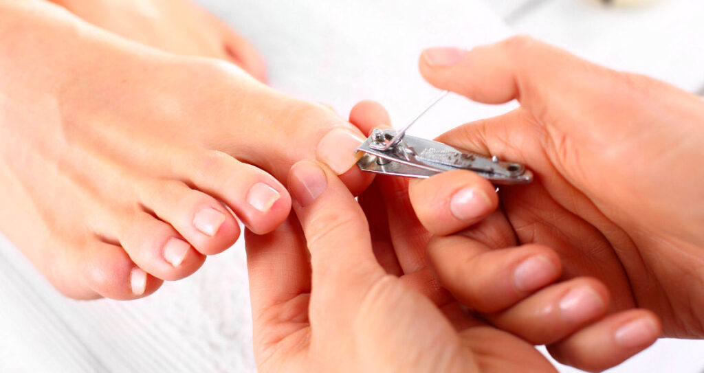 Tips for cutting your toenails