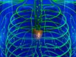 Lymphatic System