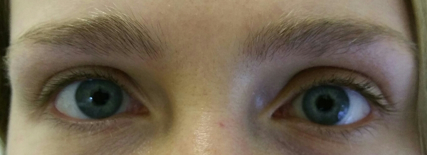 Eyelash Lift and Tint before Eyelash Lift and Tint - Before